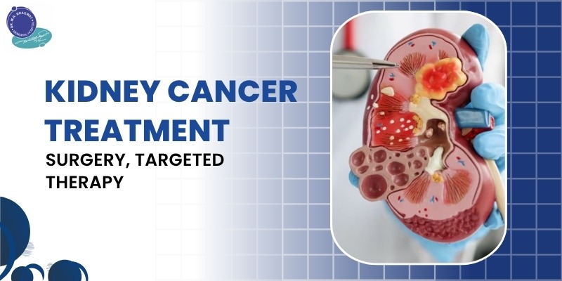 Kidney cancer treatment including surgery and targeted therapy options for effective care