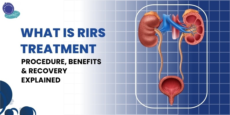 RIRS treatment procedure showing laser removal of kidney stones using a flexible ureteroscope